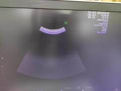 4D超音波診断装置（カラードプラ）｜Voluson E10｜GEヘルスケアの写真16枚目