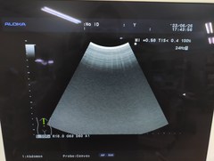 超音波診断装置（カラー）｜Prosound α6｜日立製作所の写真16枚目