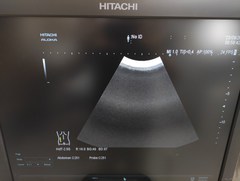超音波診断装置｜ARIETTA S70｜日立製作所の写真16枚目