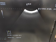超音波診断装置｜ARIETTA 60｜日立製作所の写真16枚目