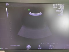 4D超音波診断装置（カラードプラ）｜Voluson E10｜GEヘルスケアの写真16枚目