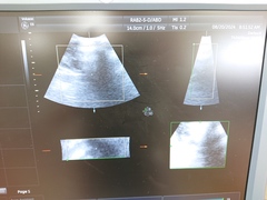 4D超音波診断装置（カラードプラ）｜Voluson E6｜GEヘルスケアの写真16枚目