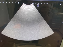 超音波診断装置(カラードプラ)ＬＣＤ｜Aplio 400 TUS-A400｜キヤノンメディカルシステムズの写真14枚目