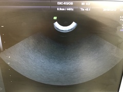 ４Ｄ超音波診断装置（カラードプラ）｜Voluson e｜GEヘルスケアの写真17枚目
