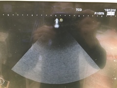 Ultrasound system｜HI VISION Preirus｜Hitachi photo17