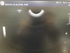 超音波診断装置｜LOGIQ S8｜GEヘルスケアの写真16枚目