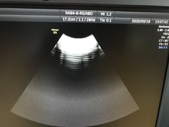 Ultrasound system(Color)｜Voluson S8｜GE Healthcare photo17