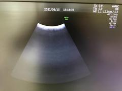 Ultrasound system(Color)｜Voluson E10｜GE Healthcare photo17