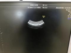 Ultrasound system(Color)｜Voluson S6｜GE Healthcare photo11