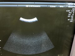 Ultrasound system(Color)｜Voluson 730 Expert｜GE Healthcare photo13