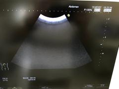 Ultrasound system(Color)｜HI VISION Avius｜Hitachi photo17