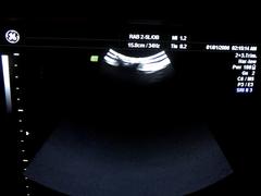 Ultrasound system(Color)｜VOLUSON 730PRO｜GE Healthcare photo17