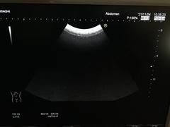 Ultrasound system(Color)｜HI VISION Avius｜Hitachi photo14