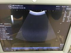 超音波診断装置（カラードプラ）｜LOGIQ P5｜GEヘルスケアの写真17枚目