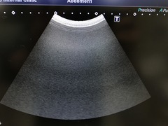 超音波診断装置（カラードプラ）｜Xario100 TUS-X100S｜キヤノンメディカルシステムズの写真14枚目
