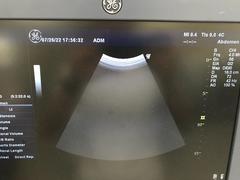 超音波診断装置（カラードプラ）｜LOGIQ P6｜GEヘルスケアの写真17枚目