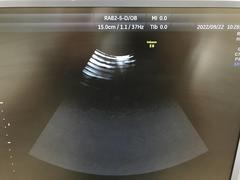 Ultrasound system(Color)｜Voluson E6｜GE Healthcare photo17