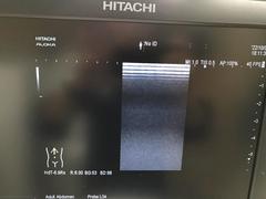Ultrasound system｜ARIETTA 60｜Hitachi photo17