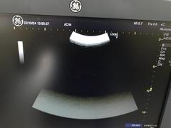 超音波診断装置（カラードプラ）｜LOGIQ V5｜GEヘルスケアの写真17枚目