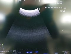 超音波診断装置｜F37｜日立製作所の写真17枚目