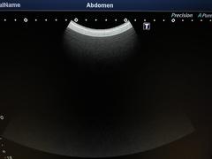 超音波診断装置（カラードプラ）｜XARIO 200 TUS‐X200｜キヤノンメディカルシステムズの写真17枚目