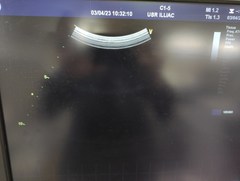 超音波診断装置(カラードプラ)ＬＣＤ｜Vivid E9 with XDclear｜GEヘルスケアの写真17枚目