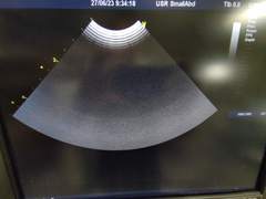 超音波診断装置(カラードプラ)ＬＣＤ｜Vivid E9 with XDclear｜GEヘルスケアの写真17枚目