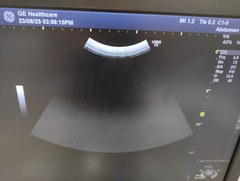 超音波診断装置｜LOGIQ P9｜GEヘルスケアの写真17枚目