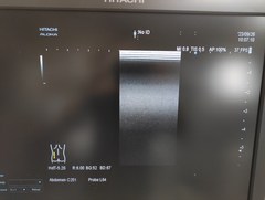 超音波診断装置｜ARIETTA S70｜日立製作所の写真17枚目