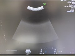 4D超音波診断装置（カラードプラ）｜Voluson E10｜GEヘルスケアの写真17枚目