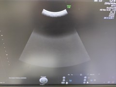 Ultrasound system(Color)｜Voluson E10｜GE Healthcare photo17