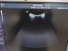 超音波診断装置（カラードプラ）｜Voluson S8｜GEヘルスケアの写真14枚目