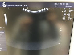 超音波診断装置の写真17枚目