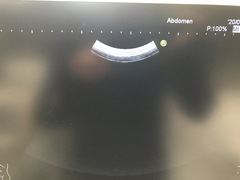 Ultrasound system(Color)｜HI VISION Avius｜Hitachi photo15