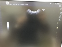 超音波診断装置の写真17枚目