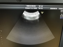 Ultrasound system(Color)｜Voluson S8｜GE Healthcare photo18