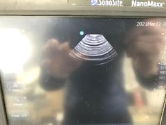 ｜SonoSite NanoMaxx｜SonoSite photo2