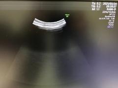 Ultrasound system(Color)｜Voluson E8｜GE Healthcare photo10