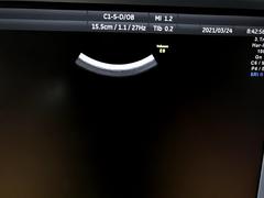 Ultrasound system(Color)｜Voluson E8｜GE Healthcare photo13