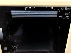 Ultrasound system｜Prosound 6｜Hitachi photo2