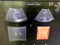 Ultrasound system(Color)｜Voluson E10｜GE Healthcare photo18