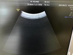 Ultrasound system(Color)｜Voluson S6｜GE Healthcare photo14