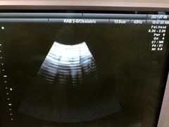 Ultrasound system(Color)｜Voluson 730 Expert｜GE Healthcare photo14