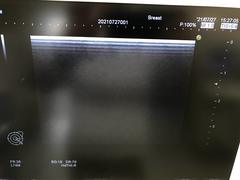 Ultrasound system(Color)｜HI VISION Avius｜Hitachi photo18