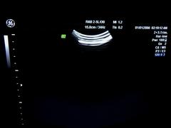 Ultrasound system(Color)｜VOLUSON 730PRO｜GE Healthcare photo18