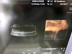 Ultrasound system(Color)｜Voluson i｜GE Healthcare photo2