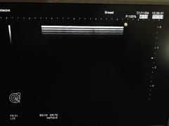 Ultrasound system(Color)｜HI VISION Avius｜Hitachi photo15