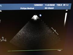 Ultrasound system｜iE33｜Philips photo18