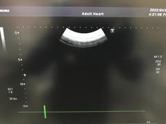 Ultrasound system(Color)｜SSA-660A Xario(LCD)｜Canon Medical Systems photo18