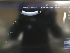超音波診断装置（カラードプラ）｜Vivid 7 Dimension｜GEヘルスケアの写真18枚目
